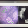 Google et le Pentagone ont mis au point un microscope basé sur l'intelligence artificielle pour le diagnostic du cancer-6