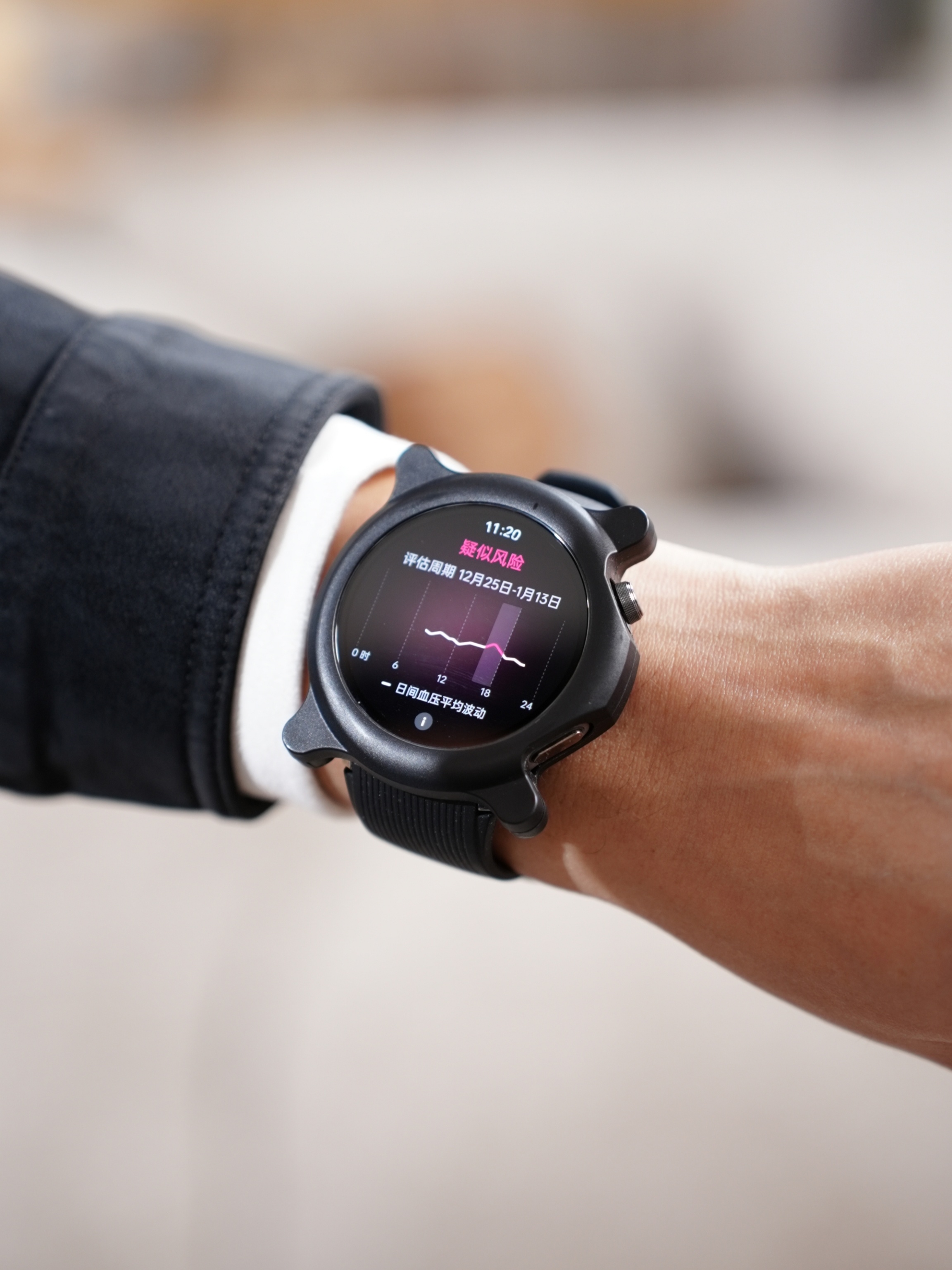 New Oppo Watch X2 in a protective case