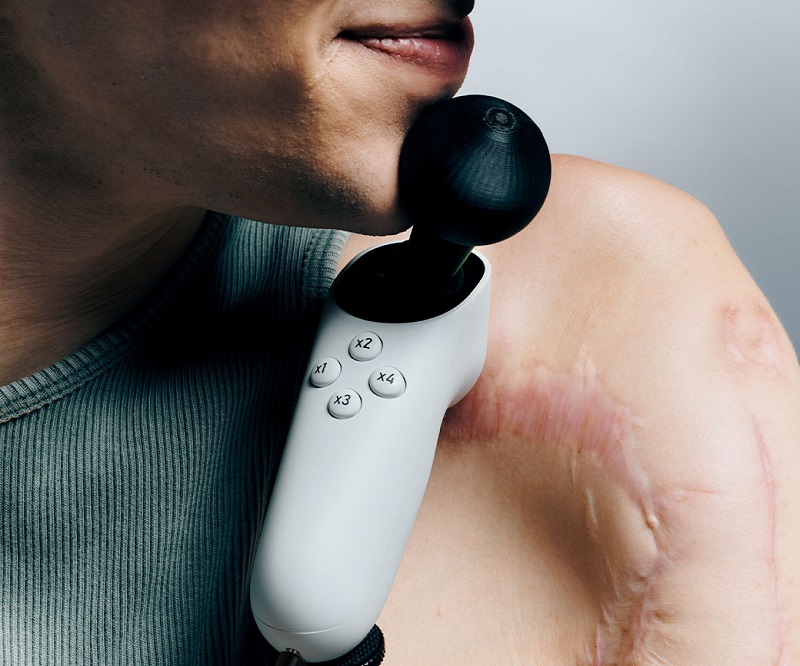 Playing will get easier: Microsoft has unveiled the Xbox Adaptive Joystick, a device compatible with Xbox, PC, Android and iOS, for people with disabilities-2